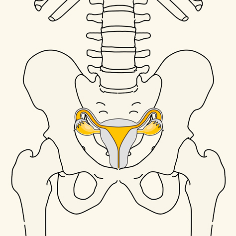 Imosteo Illu Endometriose